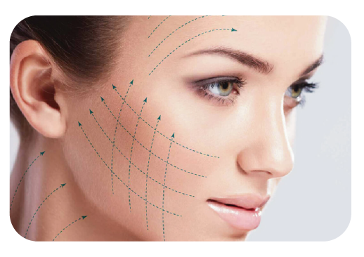 hilos-tensores-medellin